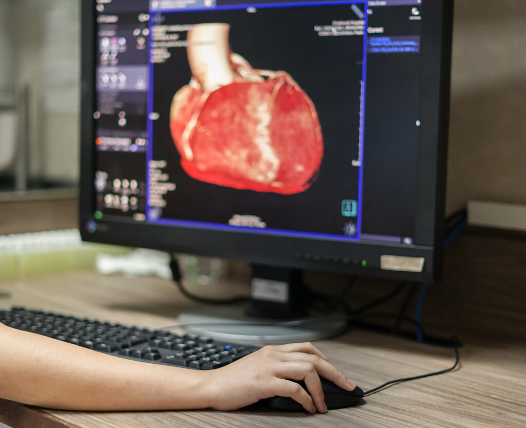 Scientist looking at a hear on a computer.